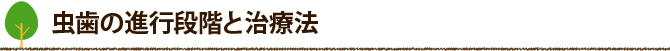 虫歯の進行段階と治療法