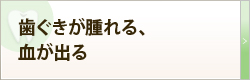 歯ぐきが腫れる、血が出る